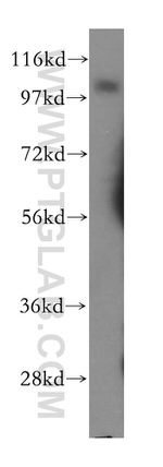 Thrombomodulin Antibody in Western Blot (WB)