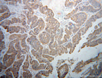 BCO2 Antibody in Immunohistochemistry (Paraffin) (IHC (P))