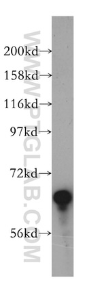 BCO2 Antibody in Western Blot (WB)