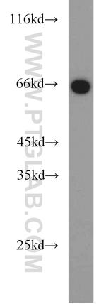 PGT Antibody in Western Blot (WB)