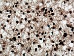 ADAR1 Antibody in Immunohistochemistry (Paraffin) (IHC (P))