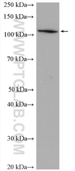 ADAR1 Antibody in Western Blot (WB)