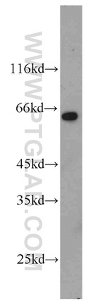 CADM1 Antibody in Western Blot (WB)