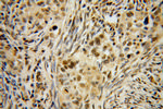 HLX Antibody in Immunohistochemistry (Paraffin) (IHC (P))