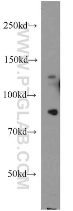 PALB2 Antibody in Western Blot (WB)