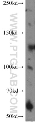 PALB2 Antibody in Western Blot (WB)