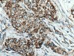 MAVS/VISA Antibody in Immunohistochemistry (Paraffin) (IHC (P))