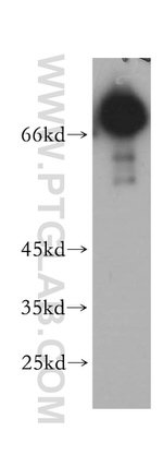 MAVS/VISA Antibody in Western Blot (WB)