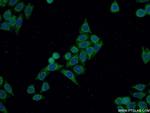 DIAPH3 Antibody in Immunocytochemistry (ICC/IF)