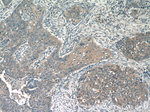 DIAPH3 Antibody in Immunohistochemistry (Paraffin) (IHC (P))