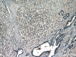 DIAPH3 Antibody in Immunohistochemistry (Paraffin) (IHC (P))