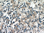 DIAPH3 Antibody in Immunohistochemistry (Paraffin) (IHC (P))