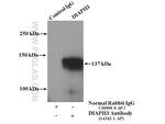 DIAPH3 Antibody in Immunoprecipitation (IP)