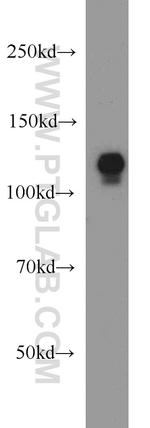 DIAPH3 Antibody in Western Blot (WB)