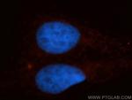 KIF4A Antibody in Immunocytochemistry (ICC/IF)