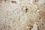 KIF4A Antibody in Immunohistochemistry (Paraffin) (IHC (P))