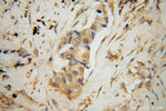 KIF4A Antibody in Immunohistochemistry (Paraffin) (IHC (P))