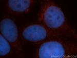 VBP1 Antibody in Immunocytochemistry (ICC/IF)