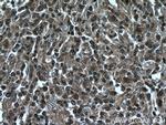 VBP1 Antibody in Immunohistochemistry (Paraffin) (IHC (P))