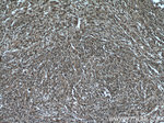 VBP1 Antibody in Immunohistochemistry (Paraffin) (IHC (P))