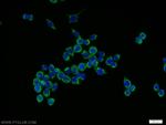NOX4 Antibody in Immunocytochemistry (ICC/IF)