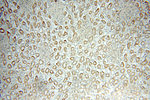 NOX4 Antibody in Immunohistochemistry (Paraffin) (IHC (P))