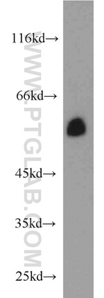 NOX4 Antibody in Western Blot (WB)