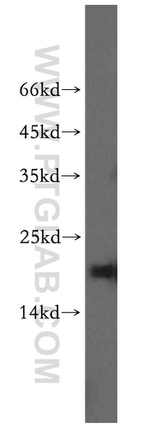 CRCP Antibody in Western Blot (WB)