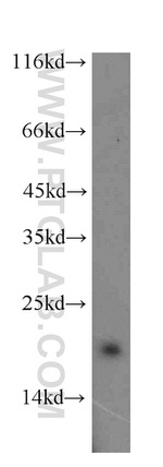 CRCP Antibody in Western Blot (WB)