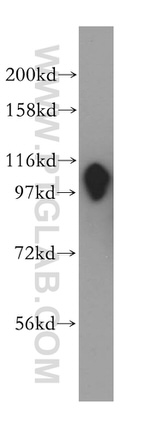 RABEP1 Antibody in Western Blot (WB)