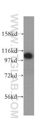 RABEP1 Antibody in Western Blot (WB)