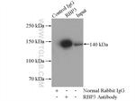 RBP3 Antibody in Immunoprecipitation (IP)