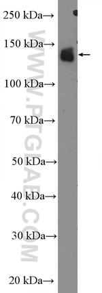 RBP3 Antibody in Western Blot (WB)