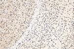 MEF2D Antibody in Immunohistochemistry (Paraffin) (IHC (P))