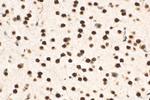 MEF2D Antibody in Immunohistochemistry (Paraffin) (IHC (P))