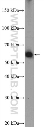 MEF2D Antibody in Western Blot (WB)