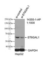 ST6GAL1 Antibody in Western Blot (WB)