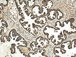 ST6GAL1 Antibody in Immunohistochemistry (Paraffin) (IHC (P))