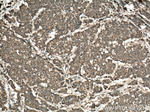 ST6GAL1 Antibody in Immunohistochemistry (Paraffin) (IHC (P))