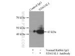 ST6GAL1 Antibody in Immunoprecipitation (IP)