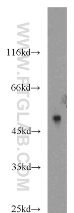 ST6GAL1 Antibody in Western Blot (WB)