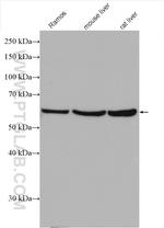 ST6GAL1 Antibody in Western Blot (WB)