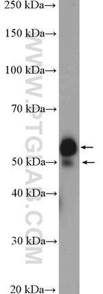 ST6GAL1 Antibody in Western Blot (WB)