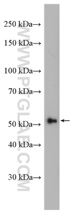 ST6GAL1 Antibody in Western Blot (WB)