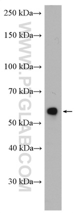 ST6GAL1 Antibody in Western Blot (WB)