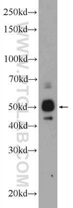 ST6GAL1 Antibody in Western Blot (WB)