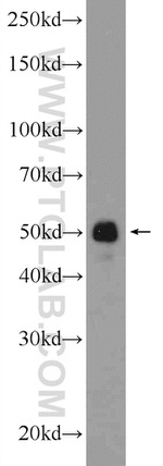 ST6GAL1 Antibody in Western Blot (WB)