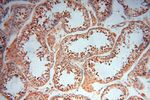 ERG Antibody in Immunohistochemistry (Paraffin) (IHC (P))