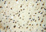 ERG Antibody in Immunohistochemistry (Paraffin) (IHC (P))