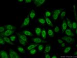 RBM3 Antibody in Immunocytochemistry (ICC/IF)